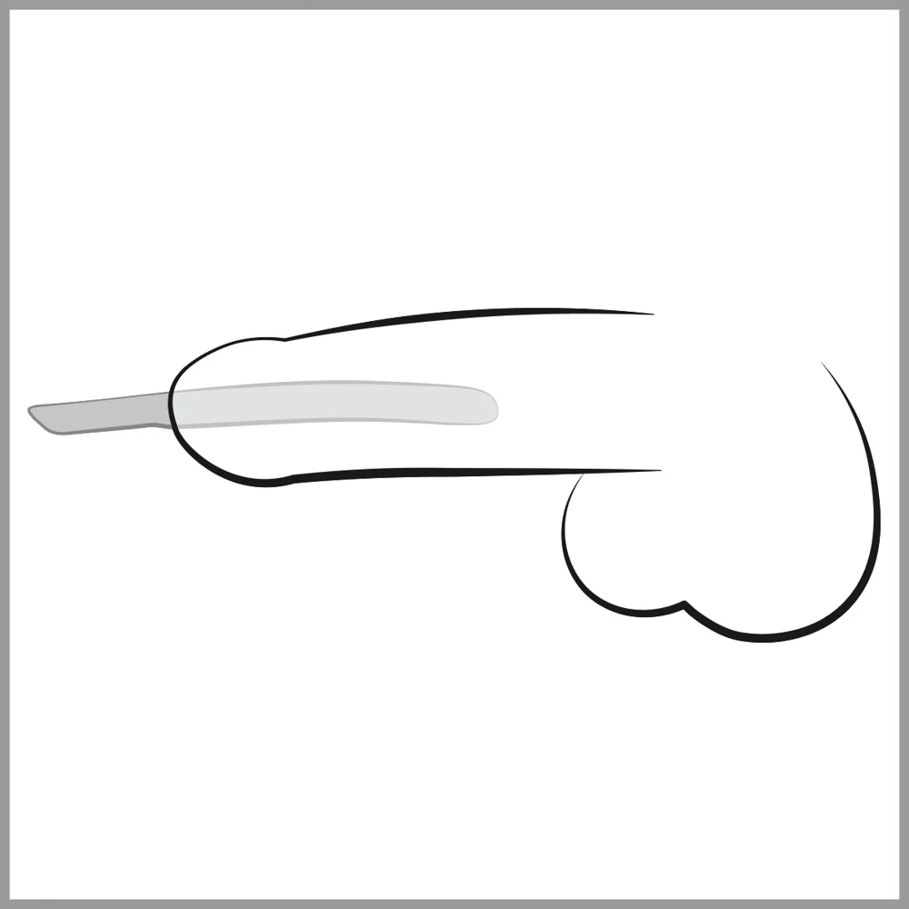 Penisplug 14-Piece Dilator Set harnröhrenstimulation