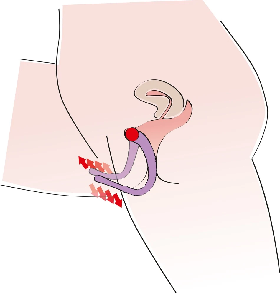Labia Spreider Intimate Spreader